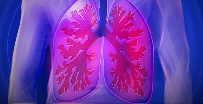 Cancro ai polmoni